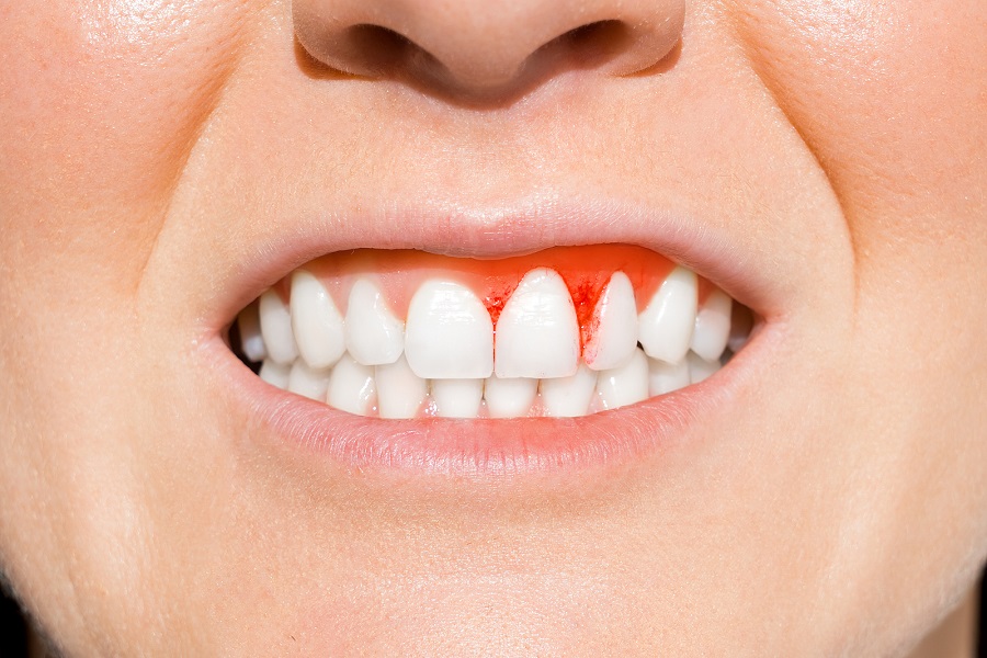 Things You Can Do To Improve Your Gum Health